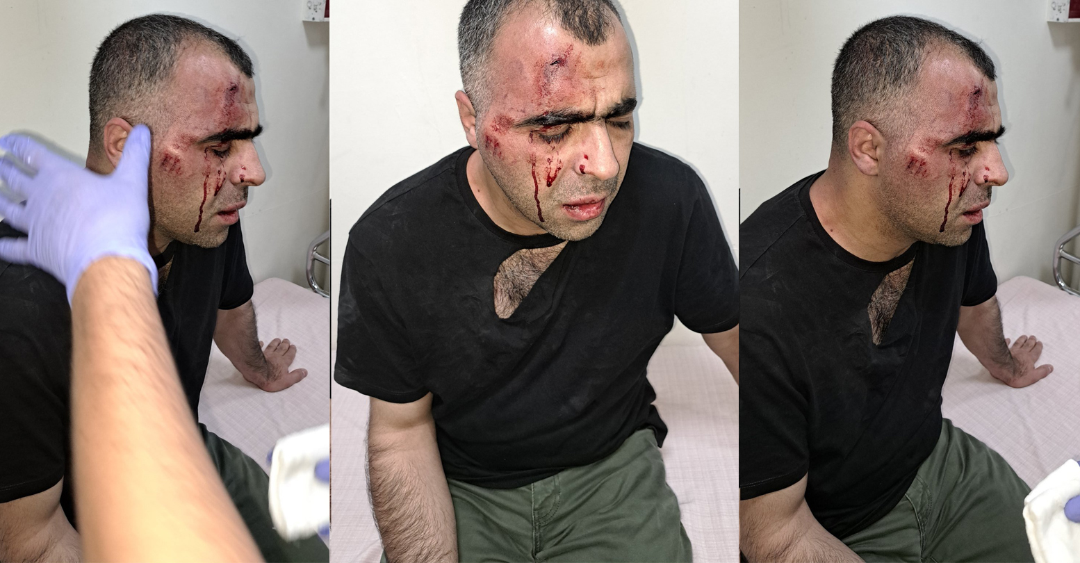 Gazeteci Aygül’e Saldırı İddianamesi Hazırlandı