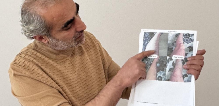 Jeoloji Mühendisi Sedef, Egzama, Uyuz ve Vitiligo İçin Krem Üretti