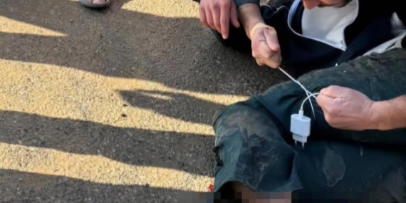 Siirt’te Meydana Gelen Kazada Yaralıya Şarj Kablosuyla Turnike Yapıldı