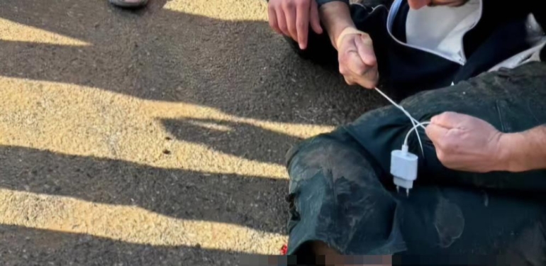 Siirt’te Meydana Gelen Kazada Yaralıya Şarj Kablosuyla Turnike Yapıldı