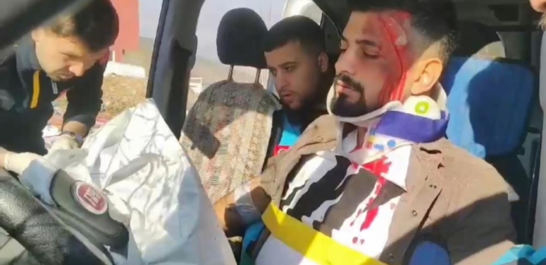 Siirt’te Fermuar Sistemi Uygulaması Anlatıldı