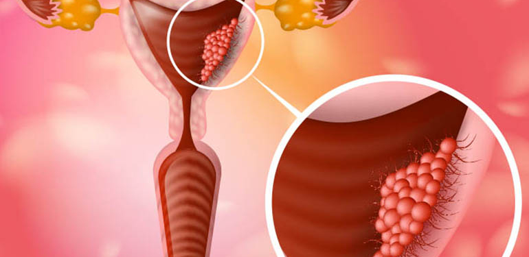 Uzman Op. Dr. Ayça Bozoklar Nuh: “Rahim Ağzı Kanseri Düzenli Taramalarla Önlenebilir”