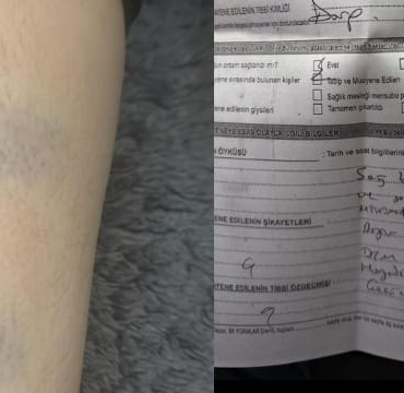 Diyarbakır’da 8 Yaşındaki Öğrenciye Şiddet İddiası