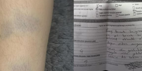 Diyarbakır’da 8 Yaşındaki Öğrenciye Şiddet İddiası